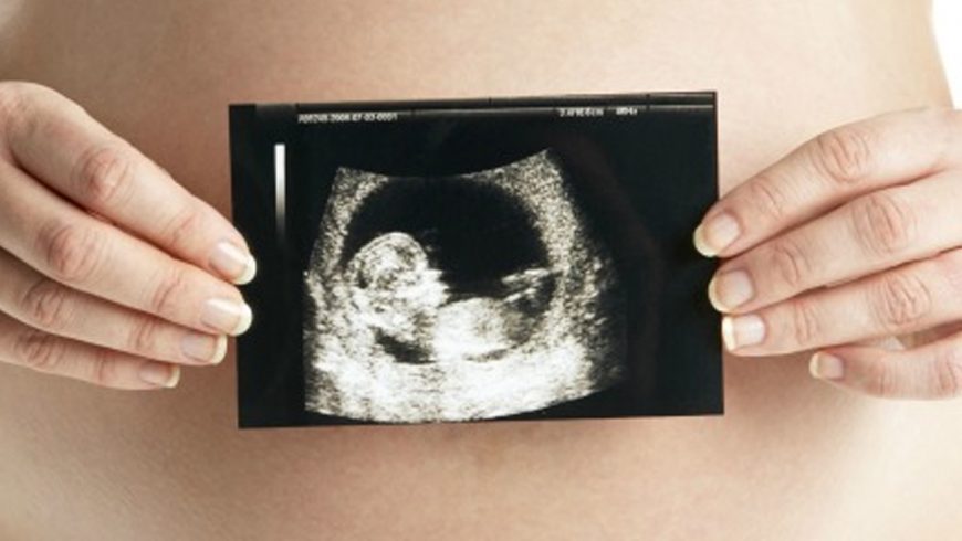 Diagnóstico antenatal de malformaciones: Un asunto de vida o muerte