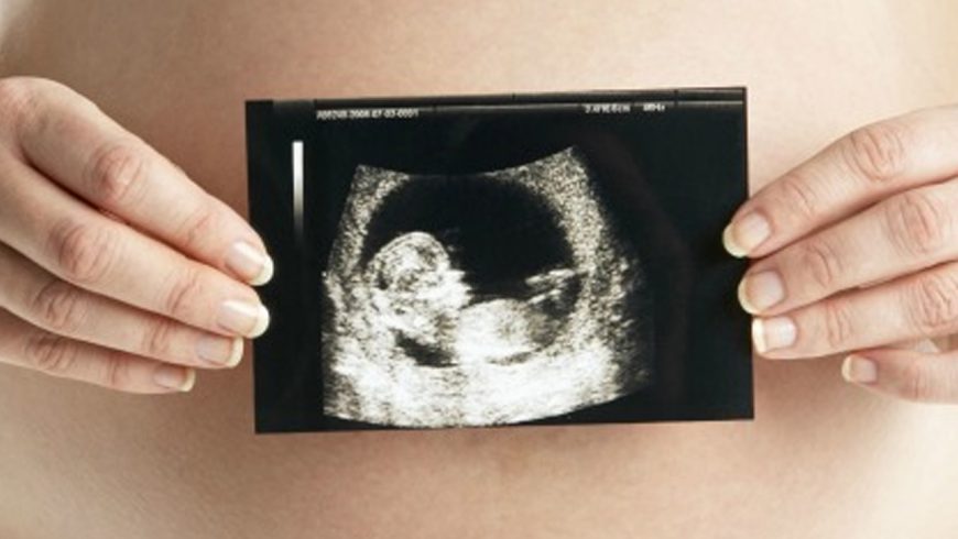 A propósito de polémica bioética en Italia: Consideraciones sobre el diagnóstico prenatal de Síndrome de Down