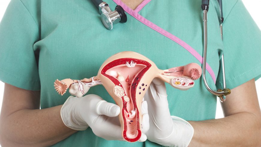 Avance ginecológico y vascular UC: Eliminar miomas sin perder el útero