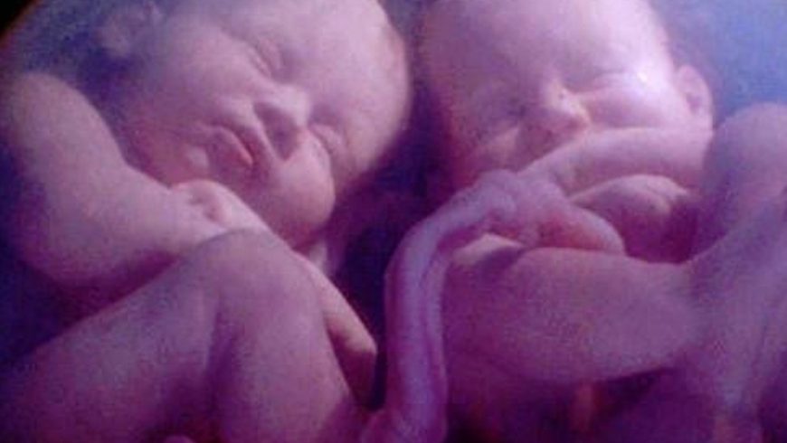 Mujeres mayores aumentan probabilidad de embarazo múltiple
